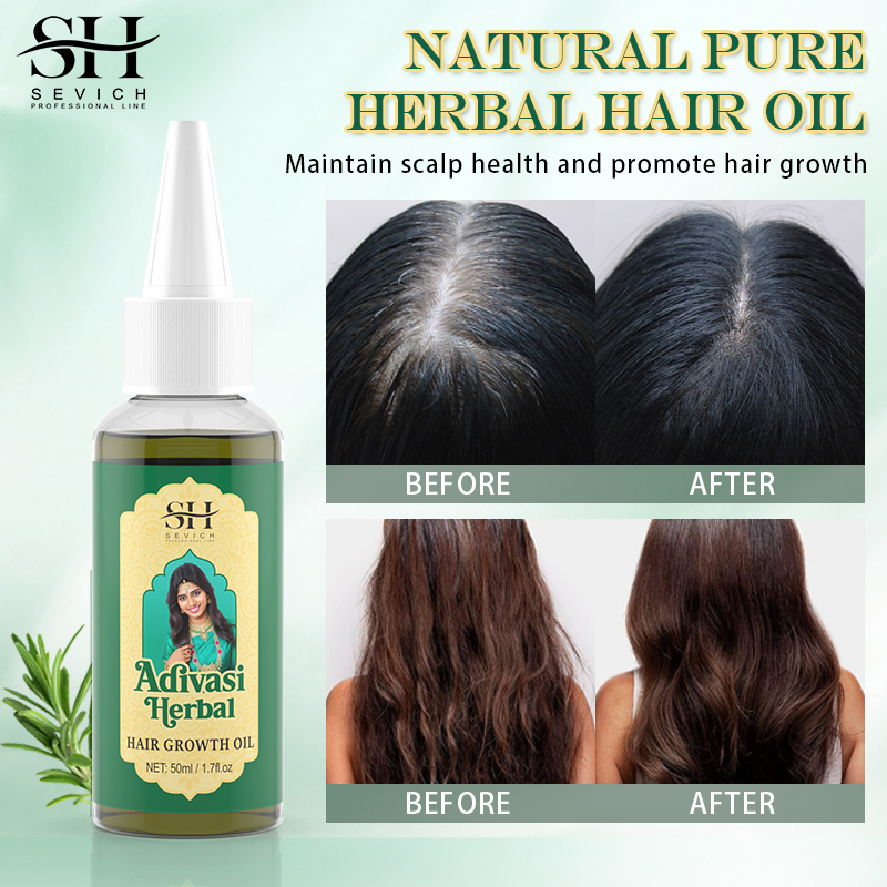Аюрведическое масло для роста  – обзор и цена Coconut Oil Refined